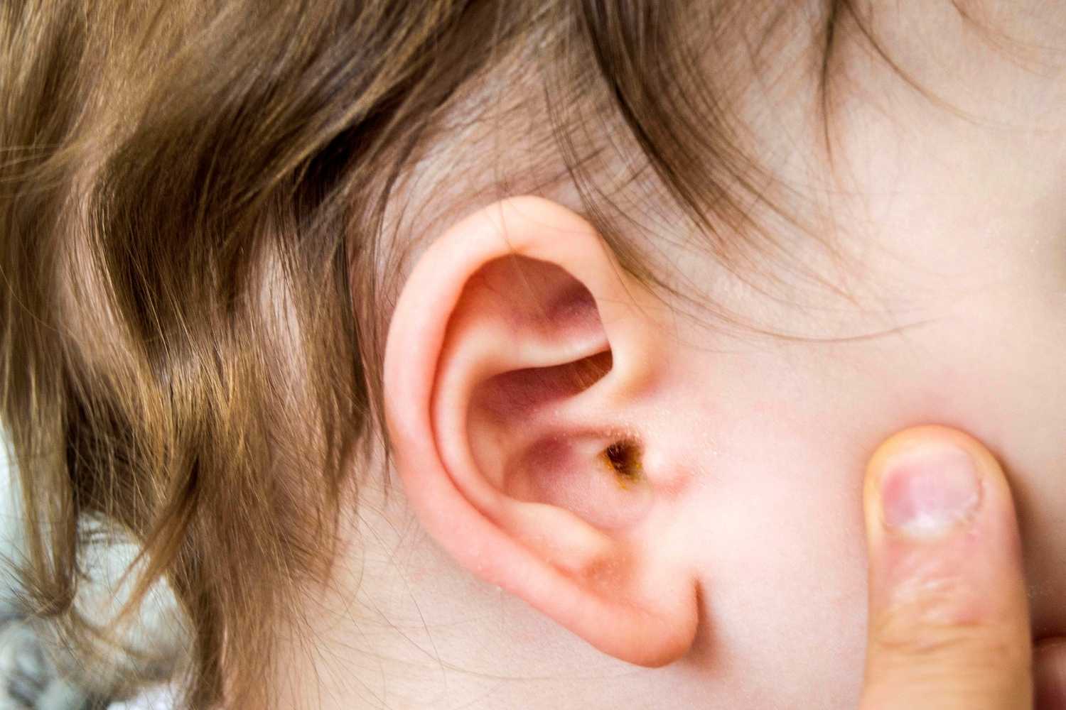 Ear Care Day