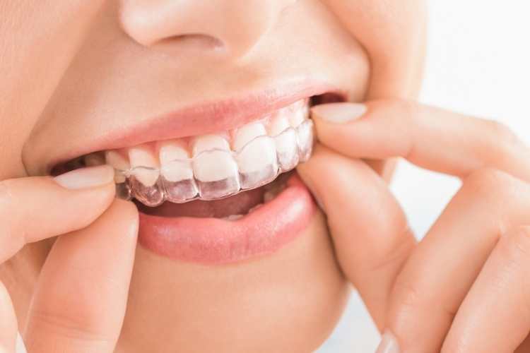 Align Your Teeth Day