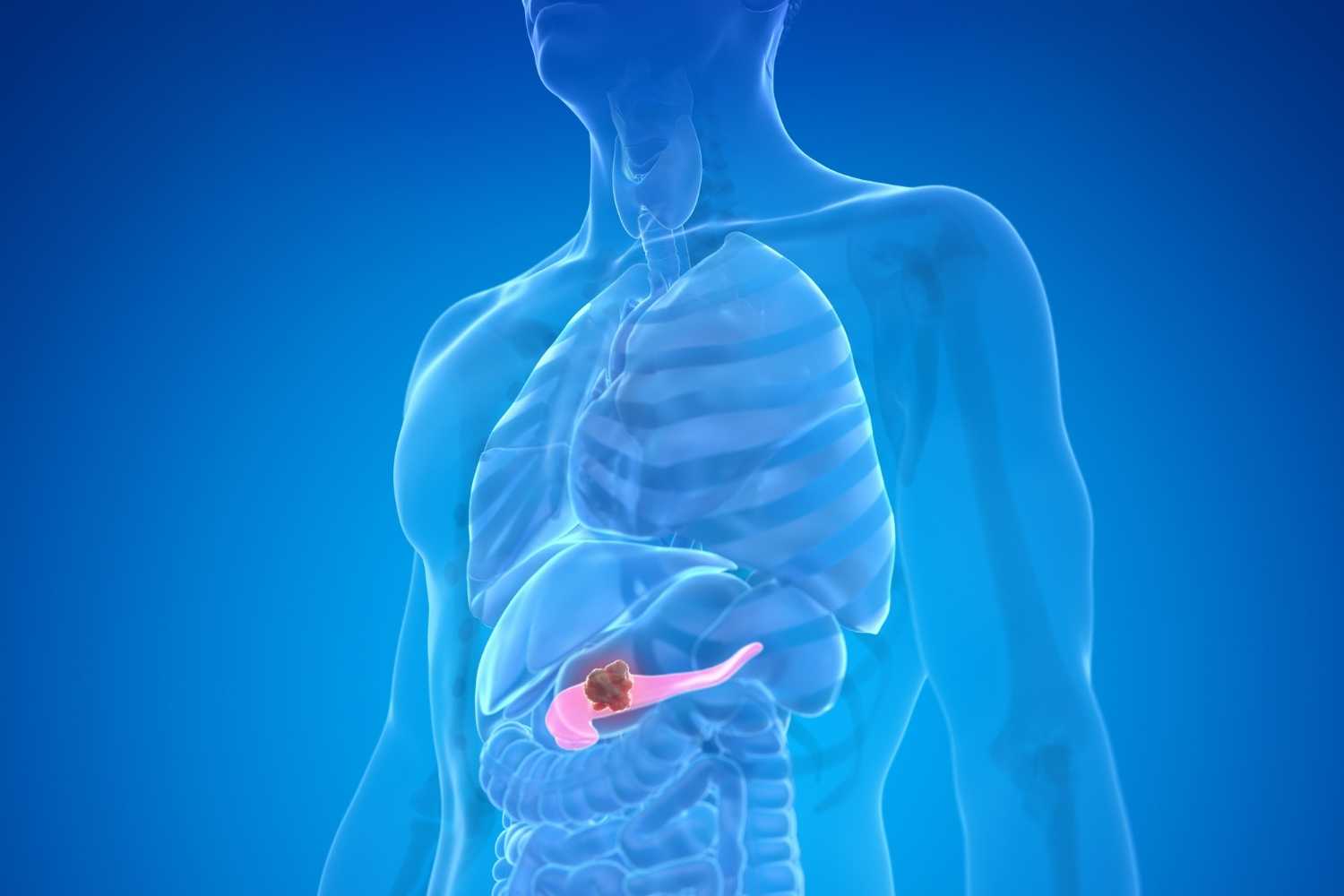 World Pancreatic Cancer Day