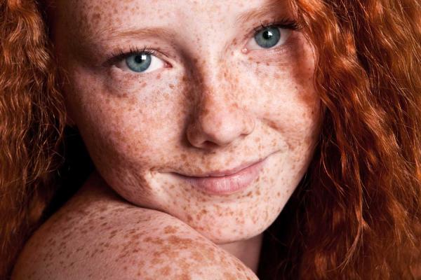 Love Your Freckles Day