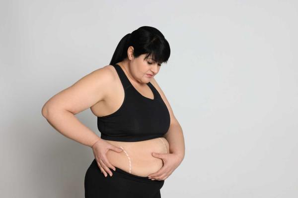 Anti-Obesity Day