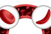 World Sickle Cell Day (WSCD) 