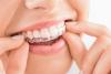 Align Your Teeth Day