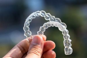 Dental Retainer Day