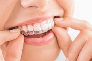 Align Your Teeth Day